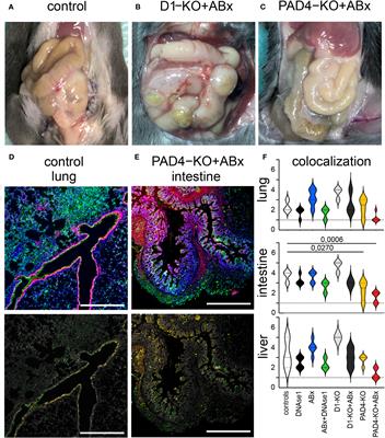 DNases improve effectiveness of antibiotic treatment in murine polymicrobial sepsis